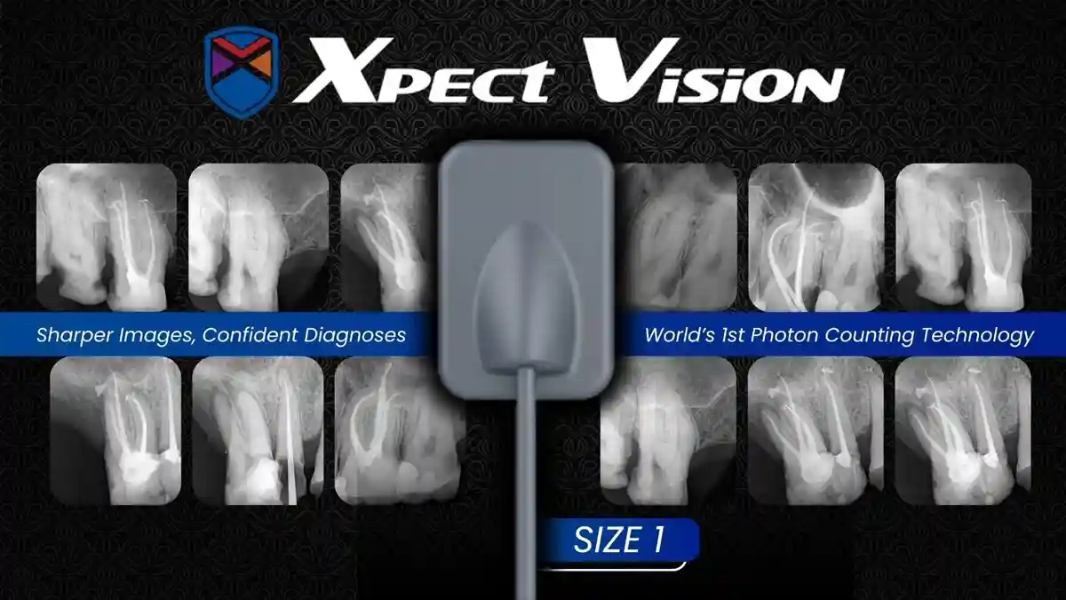 Size-1-Overview-Image AI Powered Xpect Vision Digital Dental Imaging Sensor - Image 1